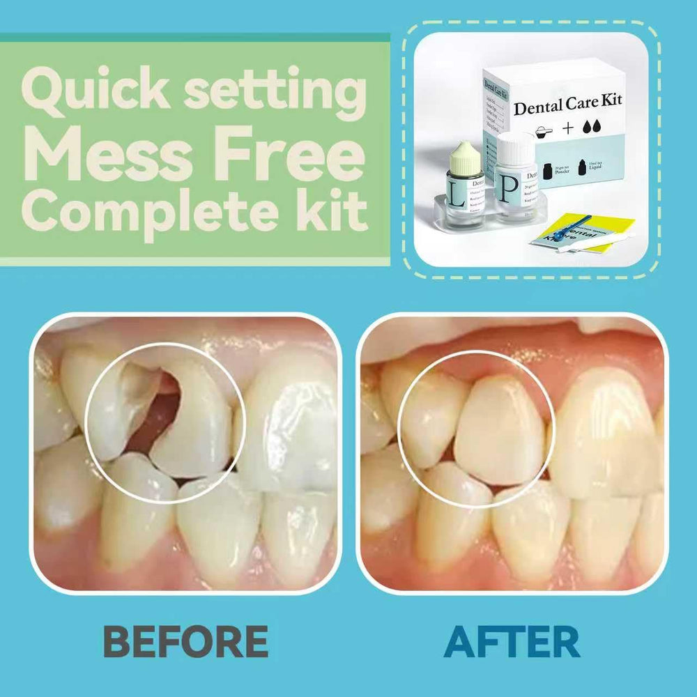 Zinc Oxide Eugenol Cement tube for temporary dental restoration
