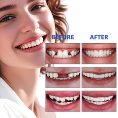 Kit instructions and tools for DIY dental repair