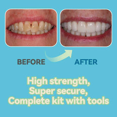 Person smiling after using the temporary tooth repair kit