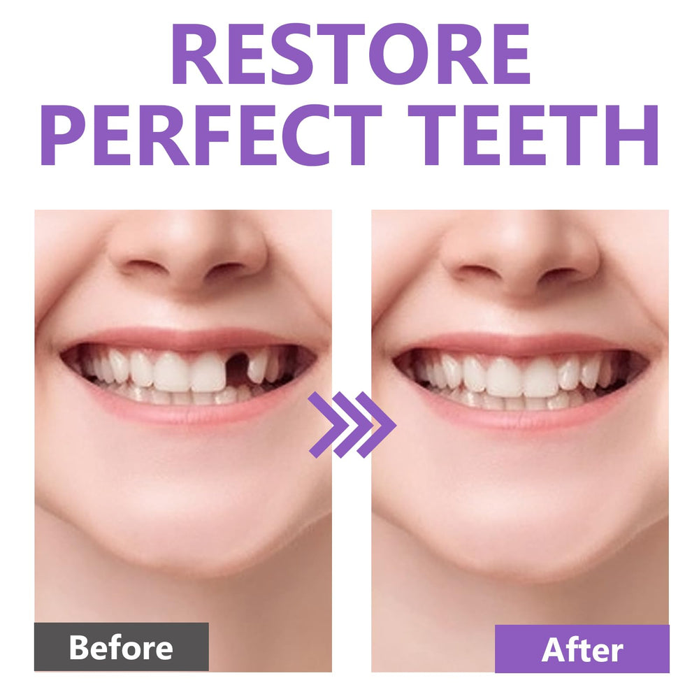 Temporary tooth held in place without glue