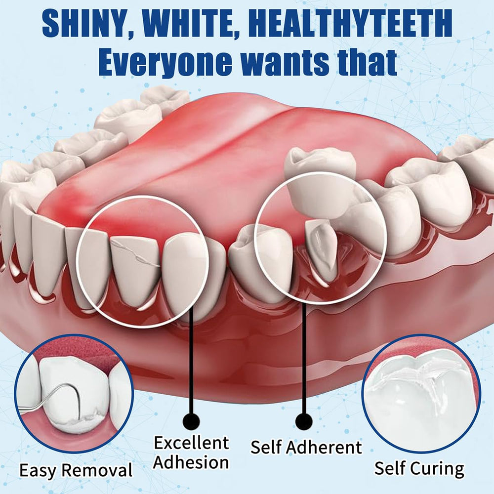 Temporary tooth repair material being prepared in the kit