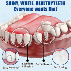 Temporary tooth repair material being prepared in the kit