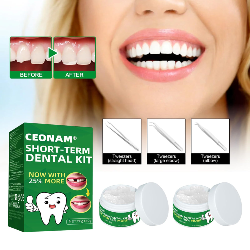 60g natural tooth shade replacement beads for temporary restoration