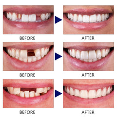 Temporary tooth repair in the mouth