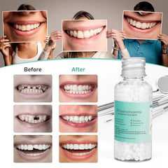 Thermoformed beads used in the kit