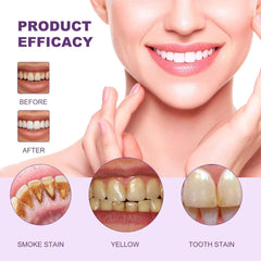 Tooth Refresh toothpaste in a travel kit