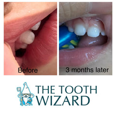 Supports a healthy oral microbiome with balanced pH