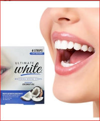 Whitening strips being applied to teeth for a 30-minute treatment