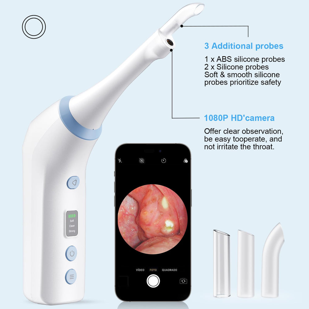 USB rechargeable tonsil stone remover