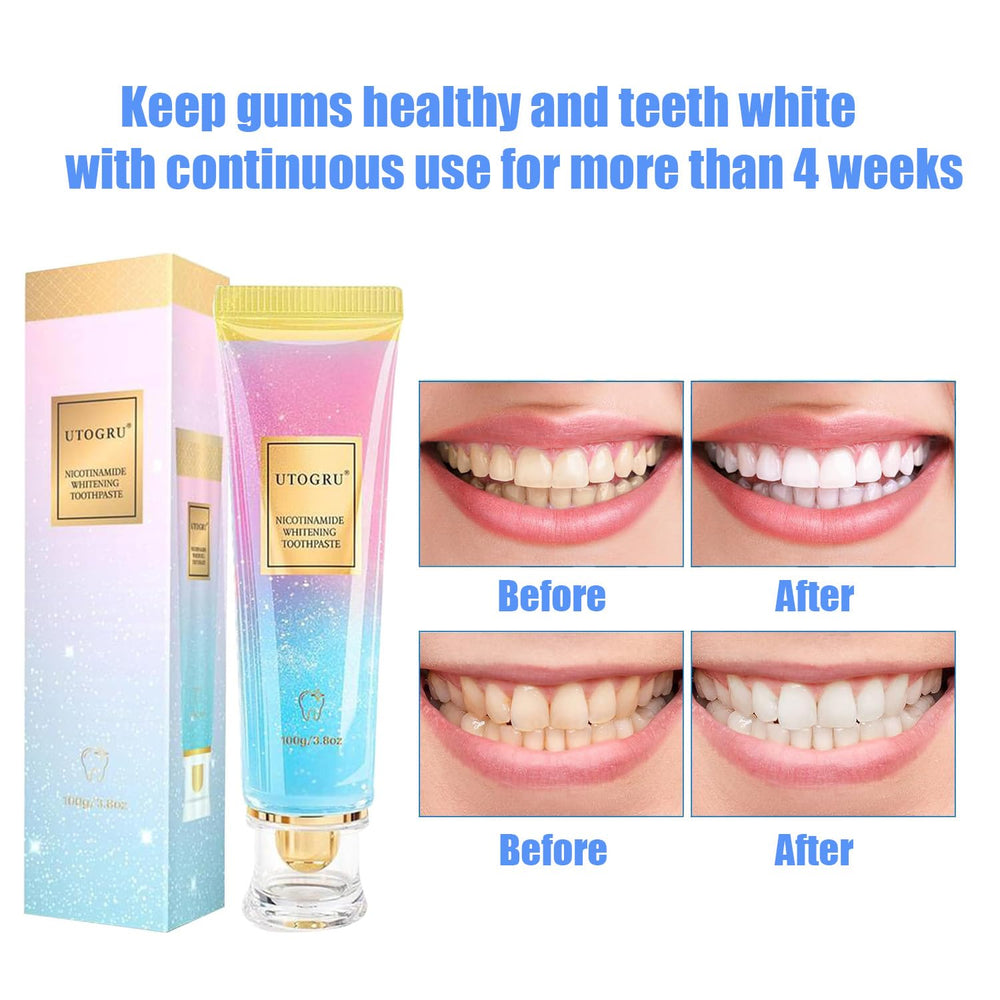 Close-up of Utogru Niacinamide Whitening Toothpaste tube