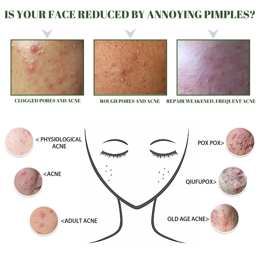 Back of bottle showing nutrition facts