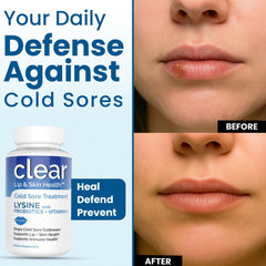Vegan, non-GMO cold sore supplement packaging