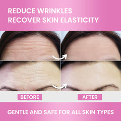 VIORY brand Forehead Wrinkle Patches product image