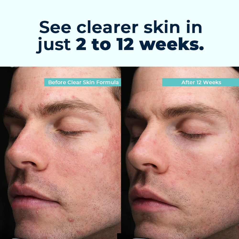 Product shot showing VitaMedica Clear Skin Vitamin Formula label