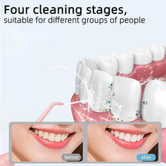 Travel bag included with water flosser