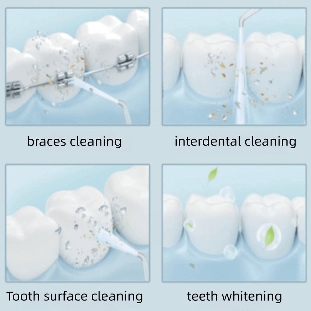 Waterpik hose and handle replacement with installation screws