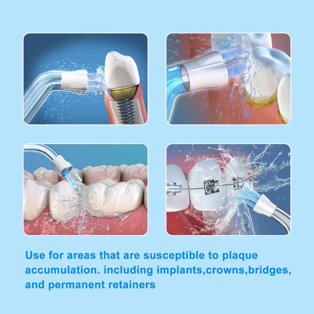 Water Flosser replacement tips in six variants for better cleaning