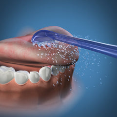 Compatibility: Waterpik Ultra, Ultra Professional, Complete Care, Cordless models, and Nano water flossers