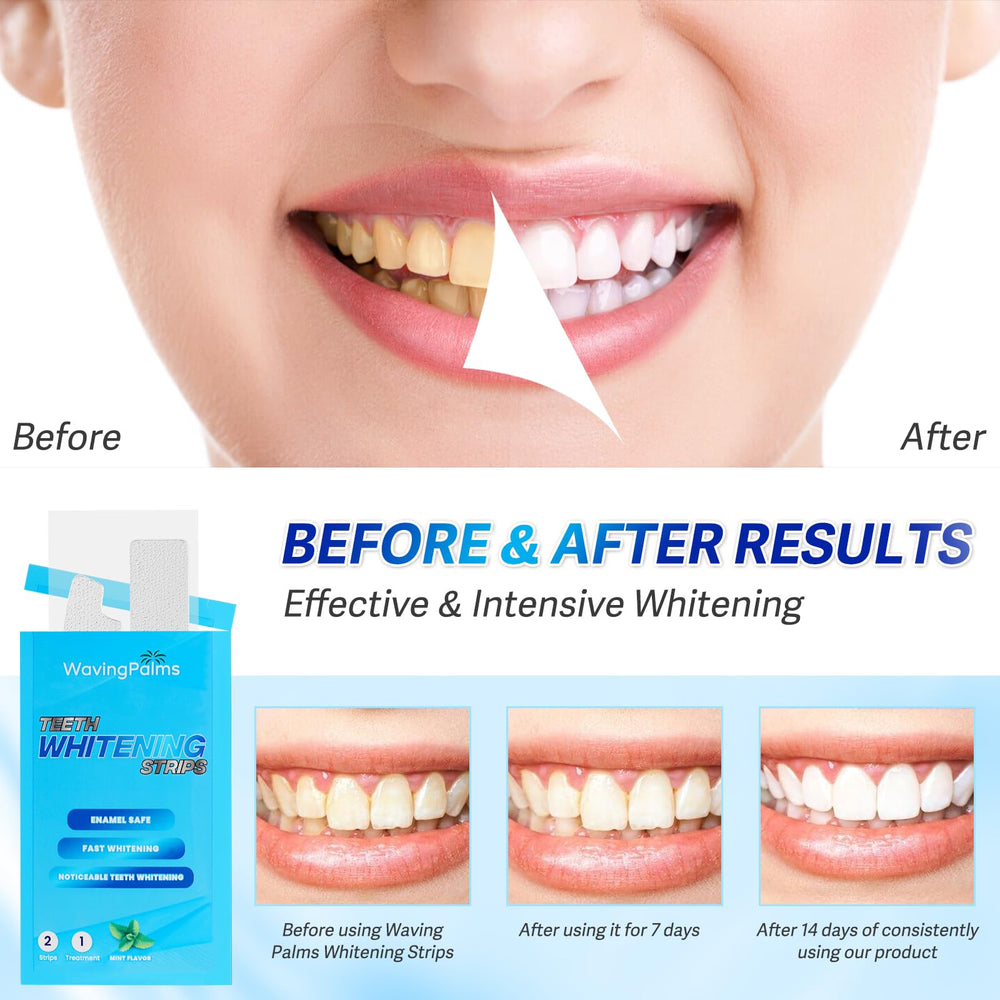 Open blister pack showing whitening strips