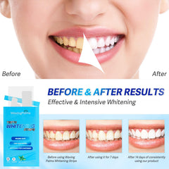 Open blister pack showing whitening strips