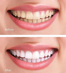 Instruction sheet included with White Teeth Global whitening kit.