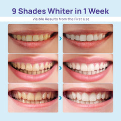 Dual LED whitening light on Whitebite Pro device