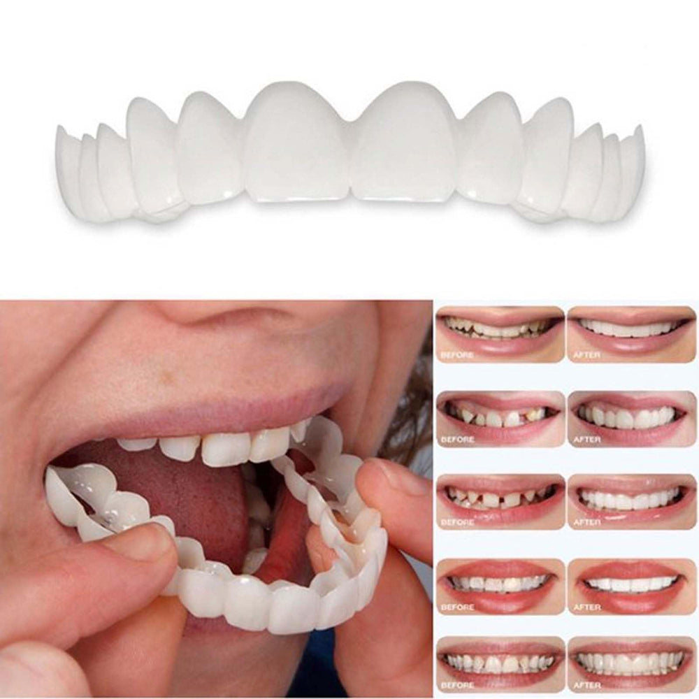 Whitening kit being used after a simple cleaning