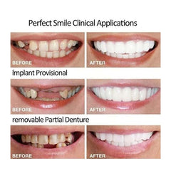 Close-up of adjustable size feature on whitening kit