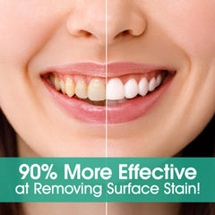 Whitening with nano-hydroxyapatite toothpaste tablets