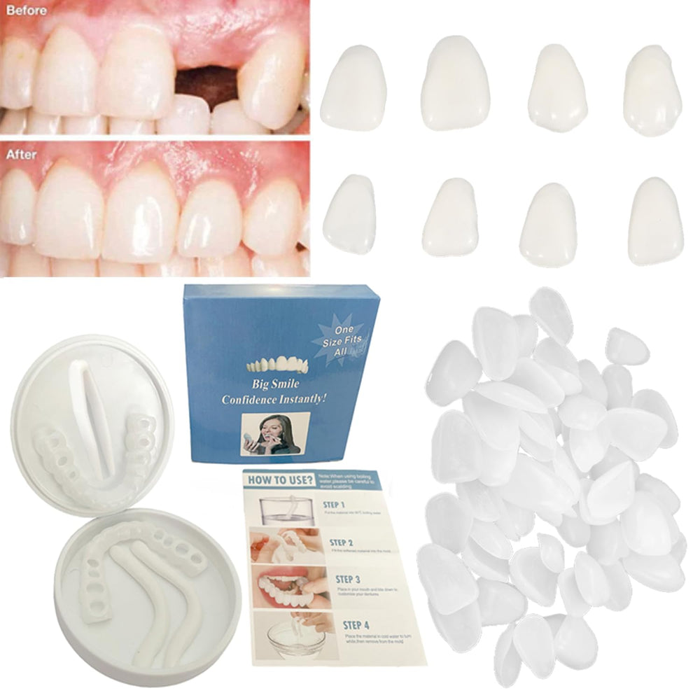 Womcare Fake Tooth Repair Kit packaging with beads