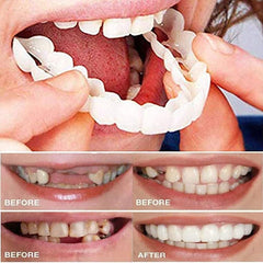 Temporary tooth restoration filling a gap in a smile