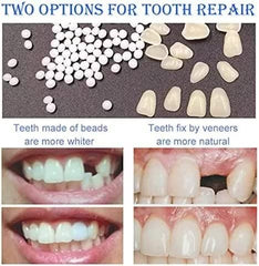 Step-by-step molding and shaping of the fake tooth