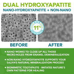 Toothpaste with xylitol for anti-cavity protection