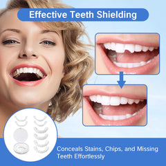 Temporary cosmetic tooth covers concealing chips and stains