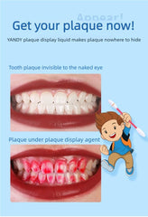 Adult using plaque disclosing tablets for targeted cleaning