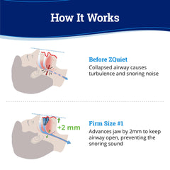 ZQuiet Firm mouthpiece box and instructions
