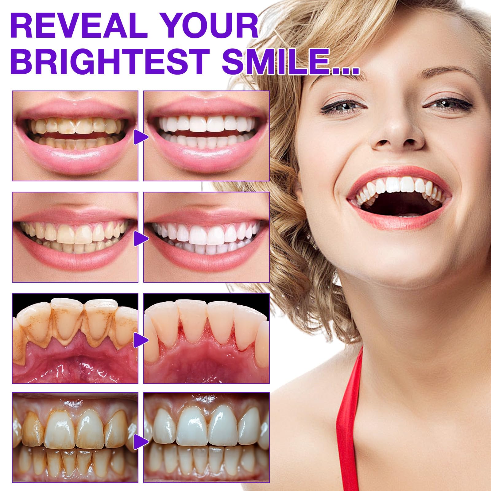 Nano hydroxyapatite whitening illustration