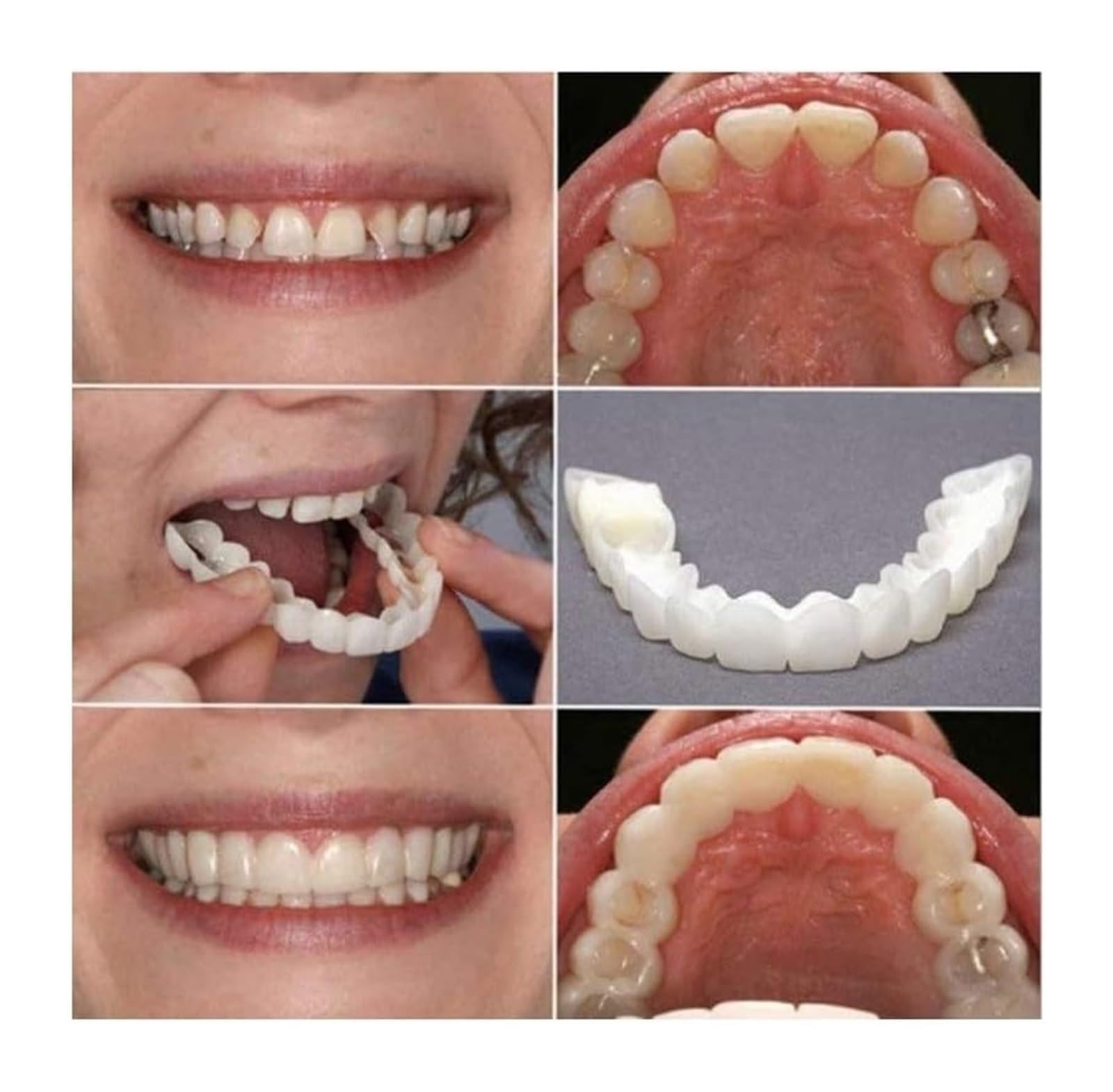Adjustable whitening trays for men and women
