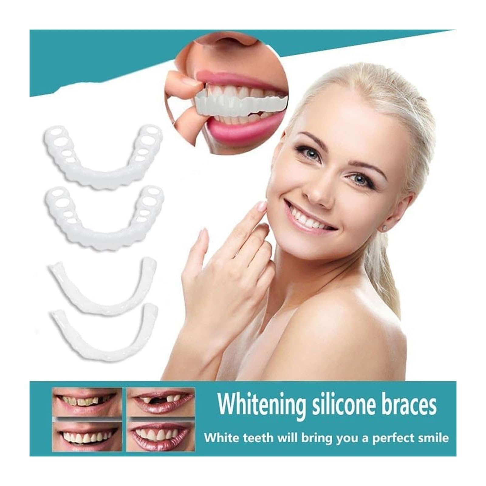 At-home whitening kit setup for use