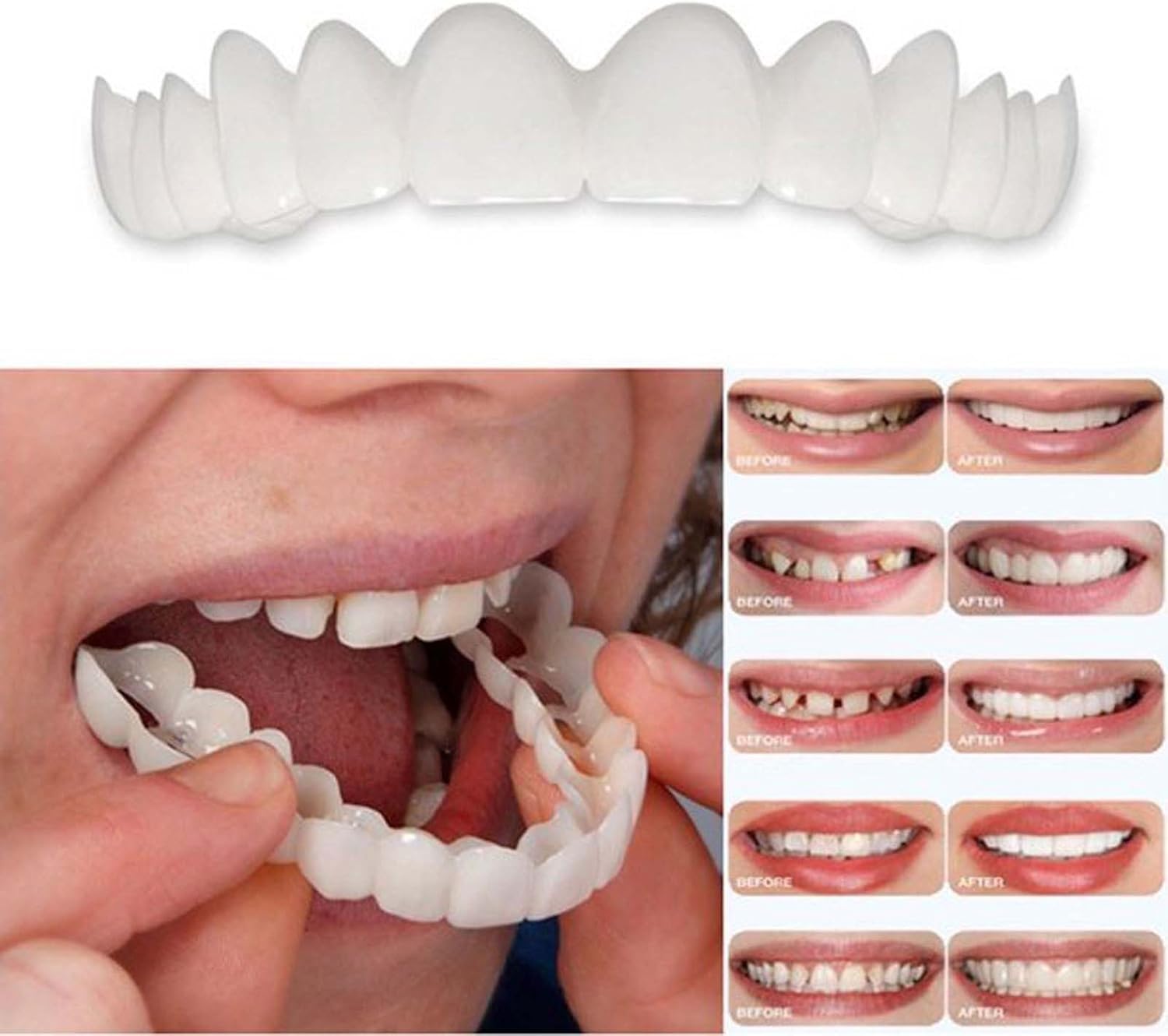 Close-up of aligners on teeth showing natural white color