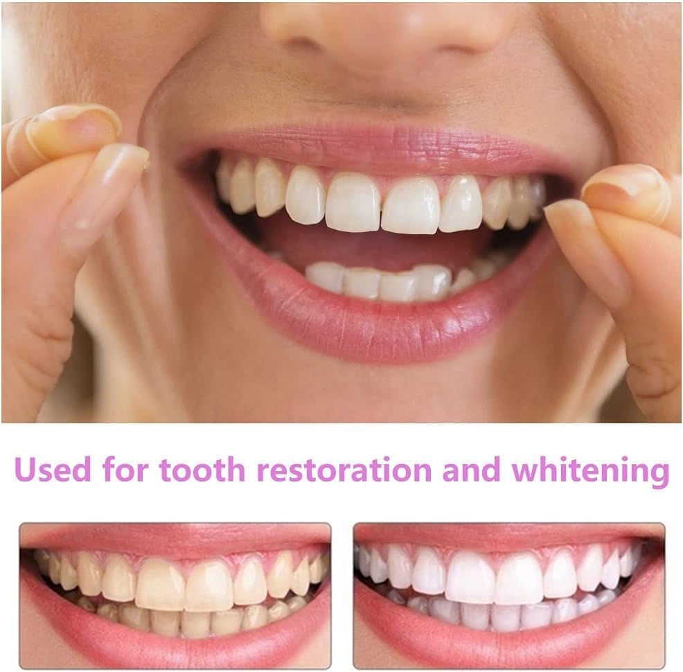 At-home fitting of smile aligners for a quick, easy fit