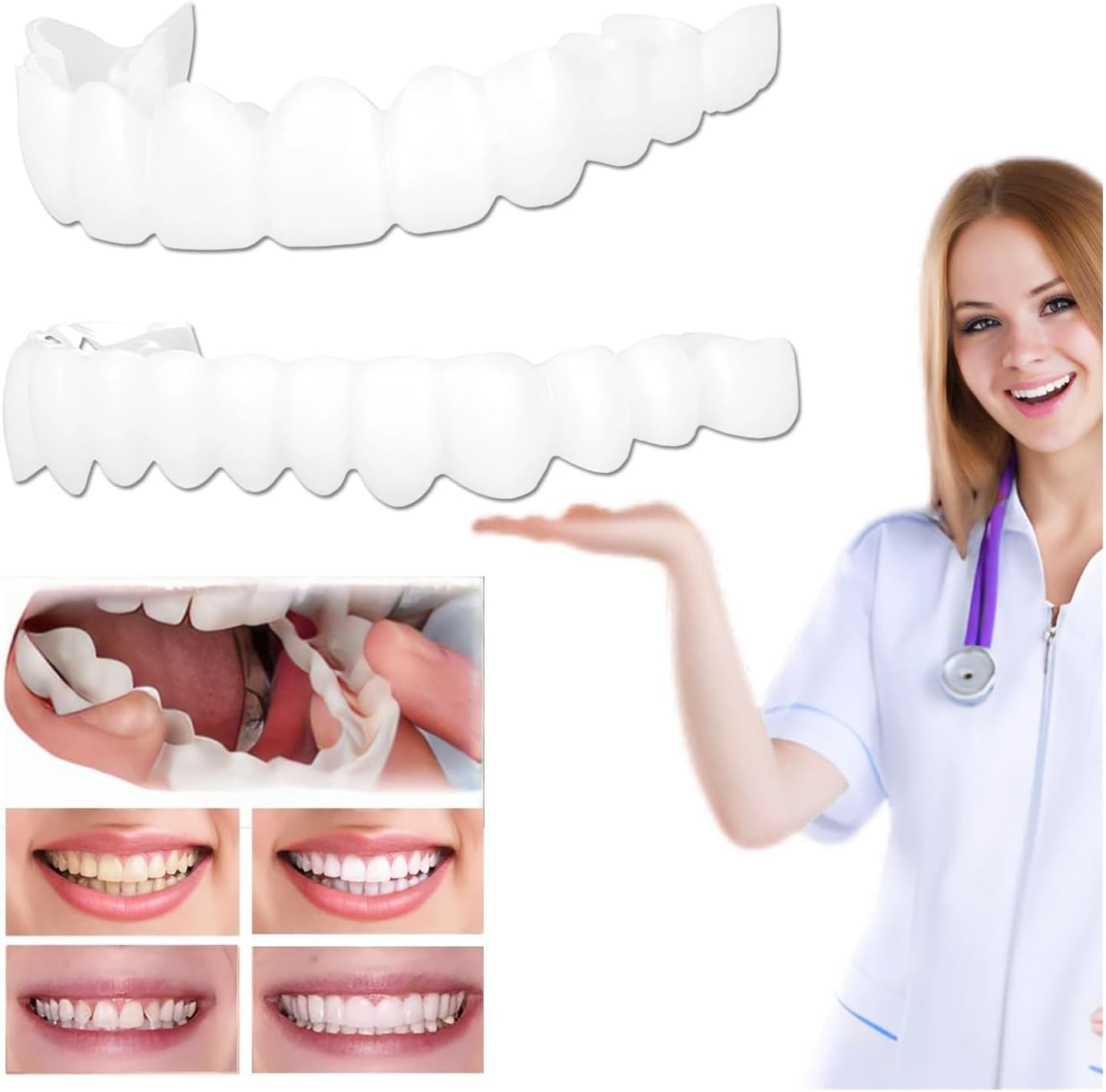 User-friendly temporary smile aligner for quick use