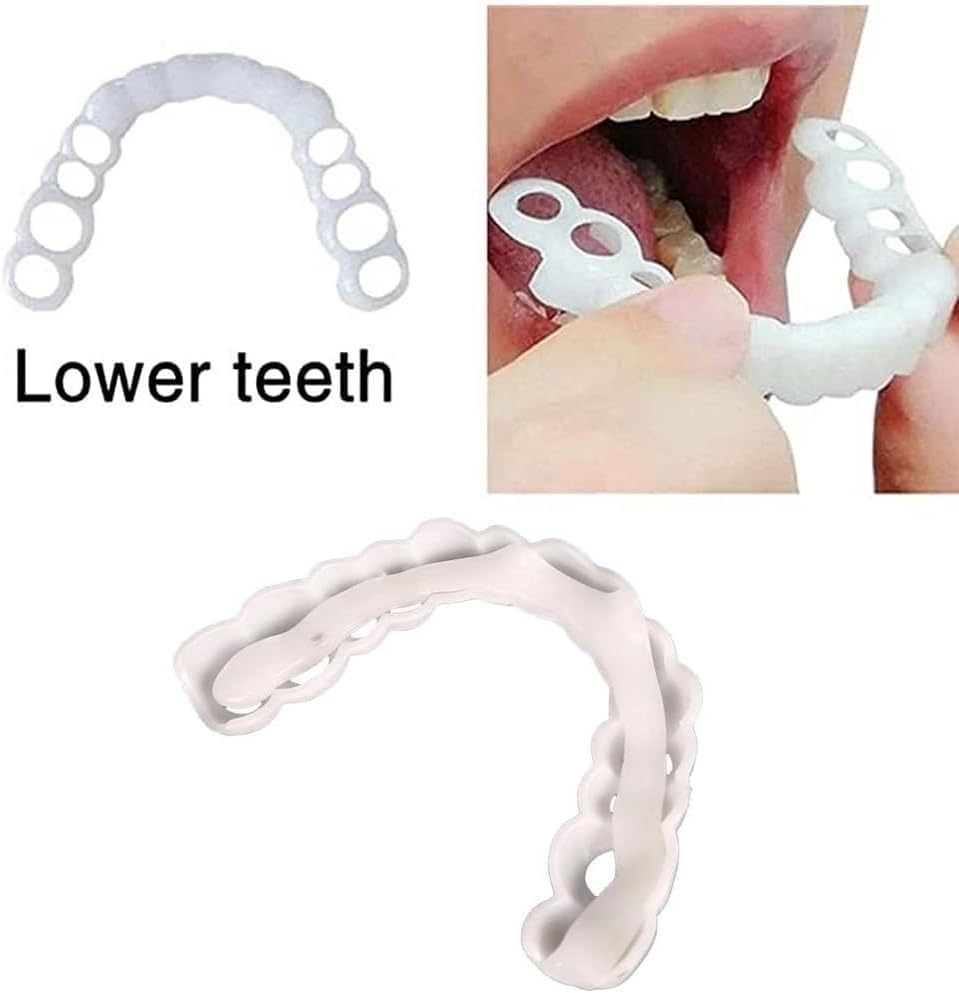 Temporary smile solution suitable for weddings, interviews, and dates
