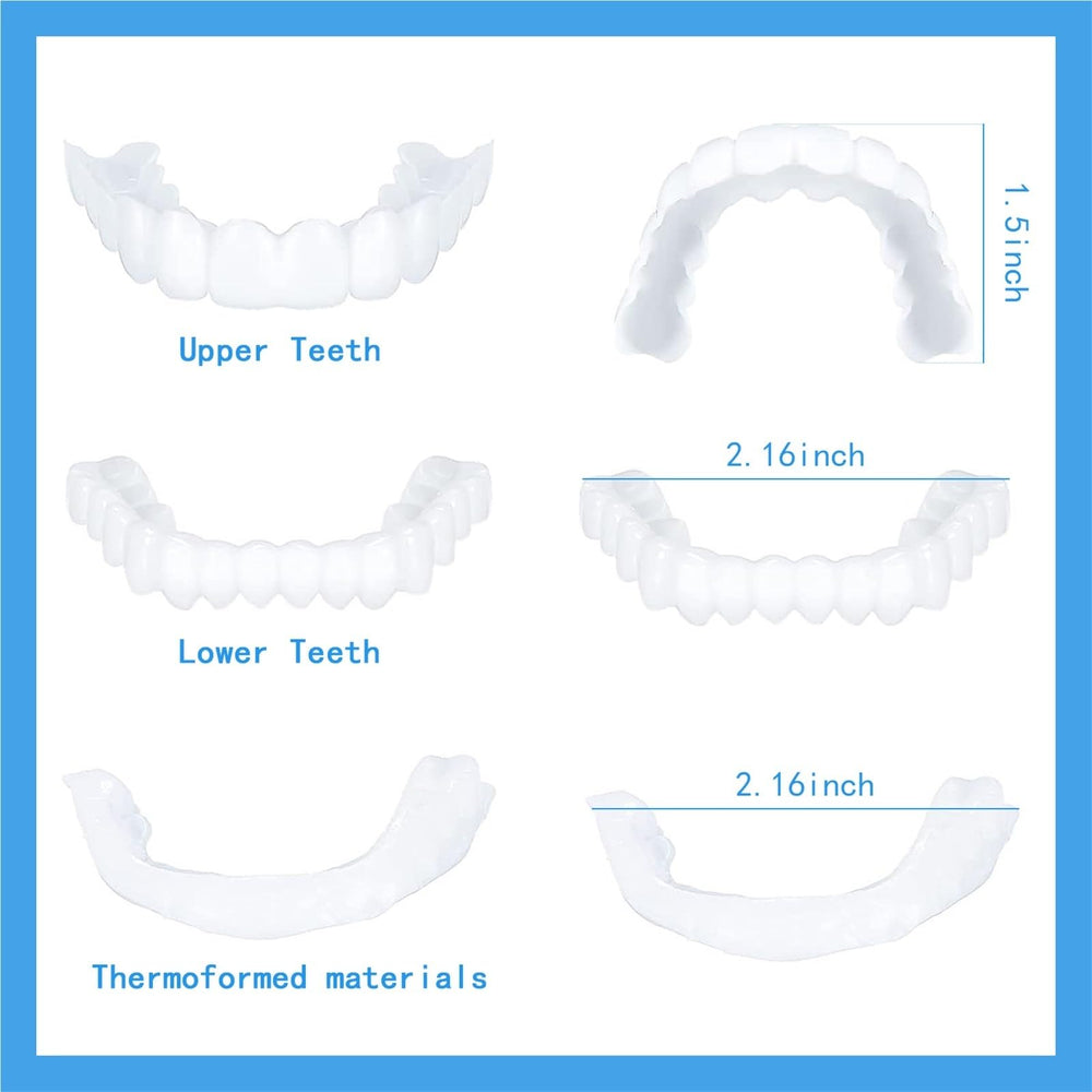 Dazzling natural-looking white temporary veneers