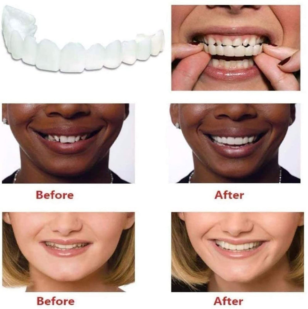 Adjustable dental aligners for men and women - size customization