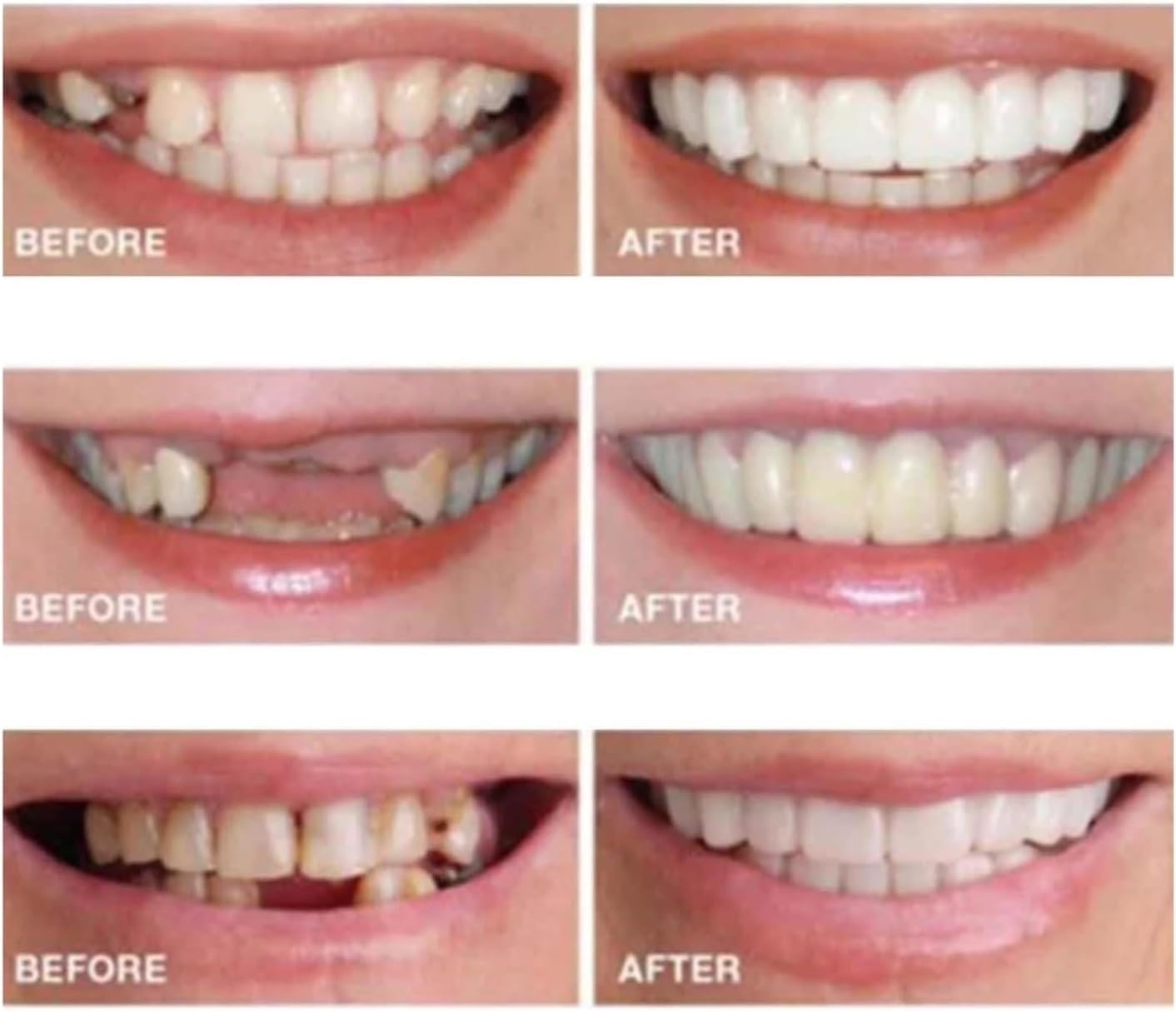 Thin and comfortable wear for temporary smile