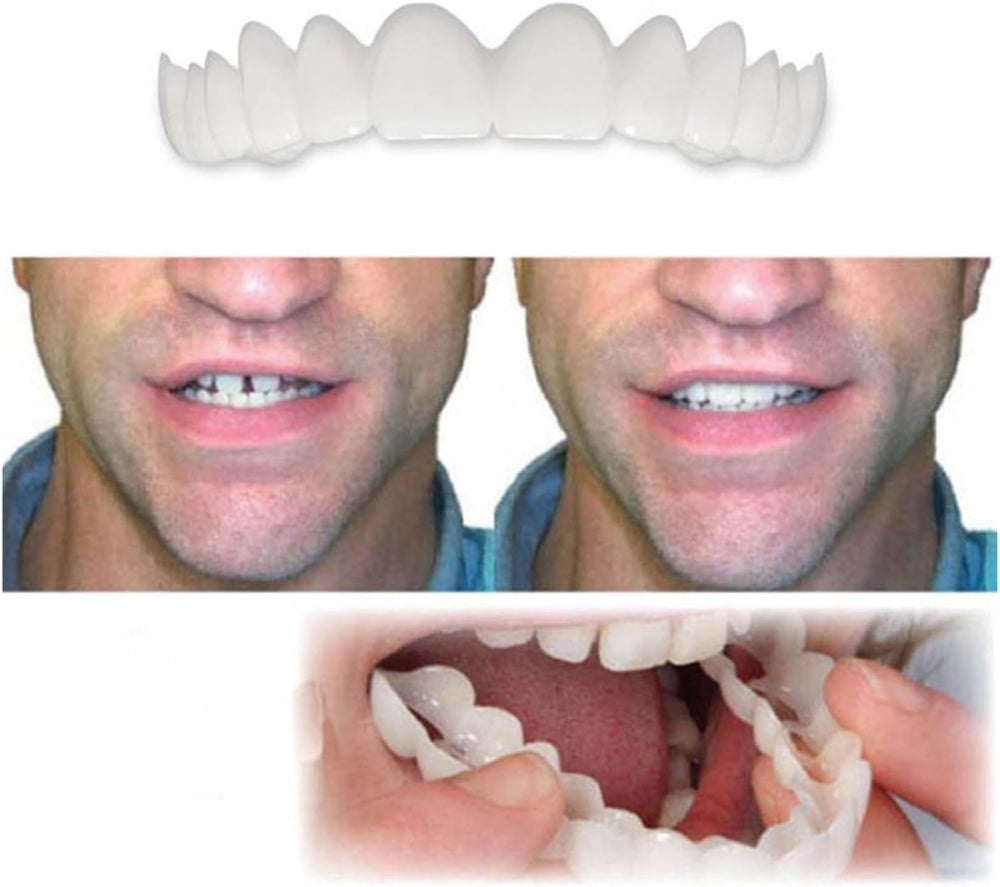 Flexible, adjustable white temporary smile parts