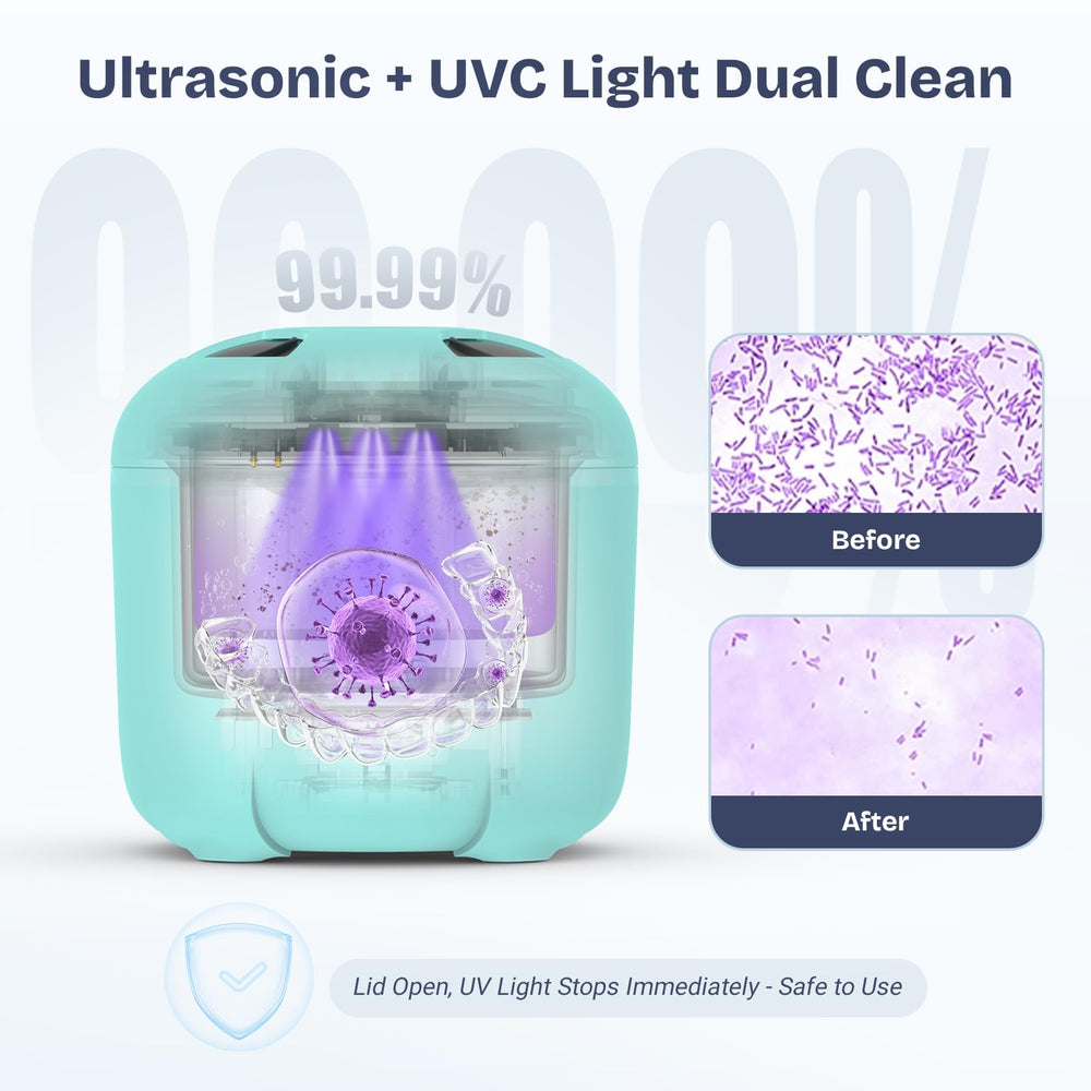 Blue 2025 Ultrasonic Retainer Cleaner angled view