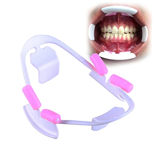 Open view showing unobstructed teeth and gums with retractor