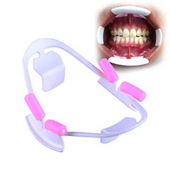 Open view showing unobstructed teeth and gums with retractor